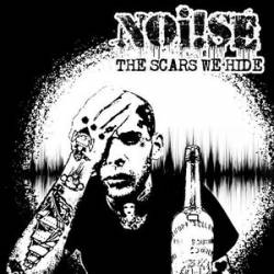 Noise : The Scars We Hide